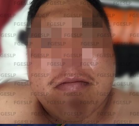 FGESLP CUMPLIMENTÓ ORDEN DE APREHENSIÓN A PRESUNTO RESPONSABLE DE ATAQUE A PDI