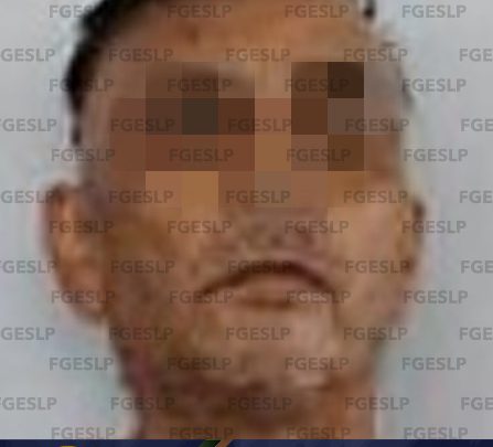 LOGRA FGE PRISIÓN PREVENTIVA PARA HOMBRE ACUSADO DE LESIONES CALIFICADAS