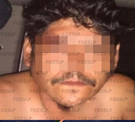 FGE CONSIGUE VINCULACIÓN A PROCESO A SEÑALADO DE LESIONAR A UN ELEMENTO DE LA PDI