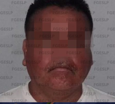 DETIENE FGESLP A UN HOMBRE BUSCADO EN NUEVO LEÓN POR VARIOS DELITOS