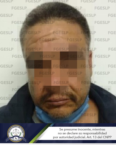 DETIENE FISCALÍA A SEÑALADO DE TENTATIVA DE FEMINICIDIO EN SLP DETIENE FISCALÍA A SEÑALADO DE TENTATIVA DE FEMINICIDIO EN SLP
