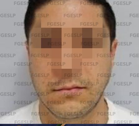 PDI REAPREHENDE A HOMBRE POR LESIONES CALIFICADAS EN SLP