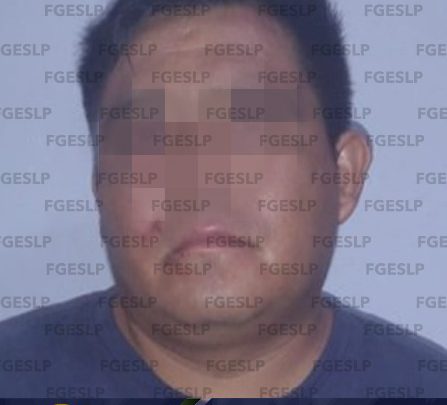 LOGRA FISCALÍA PRISIÓN PREVENTIVA PARA ACUSADO DE LESIONAR A UN HOMBRE EN TANCANHUITZ