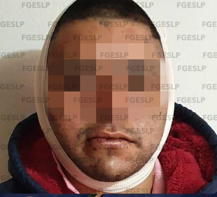 EN MATEHUALA FISCALÍA DETUVO A UN HOMBRE POR PROBABLE ROBO A UNA VIVIENDA