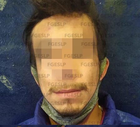 FGE DE SLP DETUVO A SUJETO POR PRESUNTAS LESIONES Y DAÑOS EN LAS COSAS