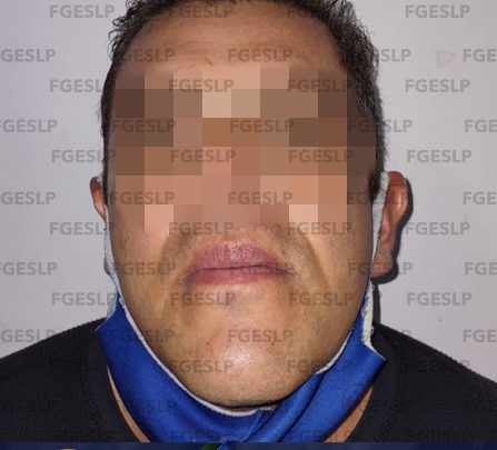 POR PROBABLE VIOLENCIA A SU PAREJA HOMBRE FUE DETENIDO POR AGENTES DE LA FGE