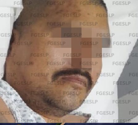 CAPTURAN A SEÑALADO DE UN HOMICIDIO EN SAN CIRO DE ACOSTA